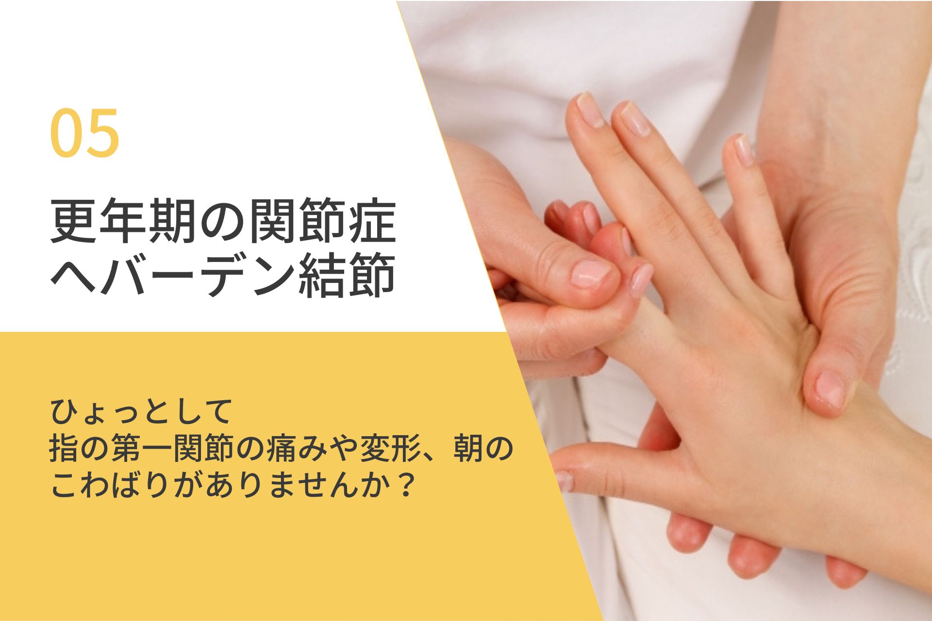 【更年期の関節症】指の第一関節が痛い。へバーデン結節の原因は女性ホルモン